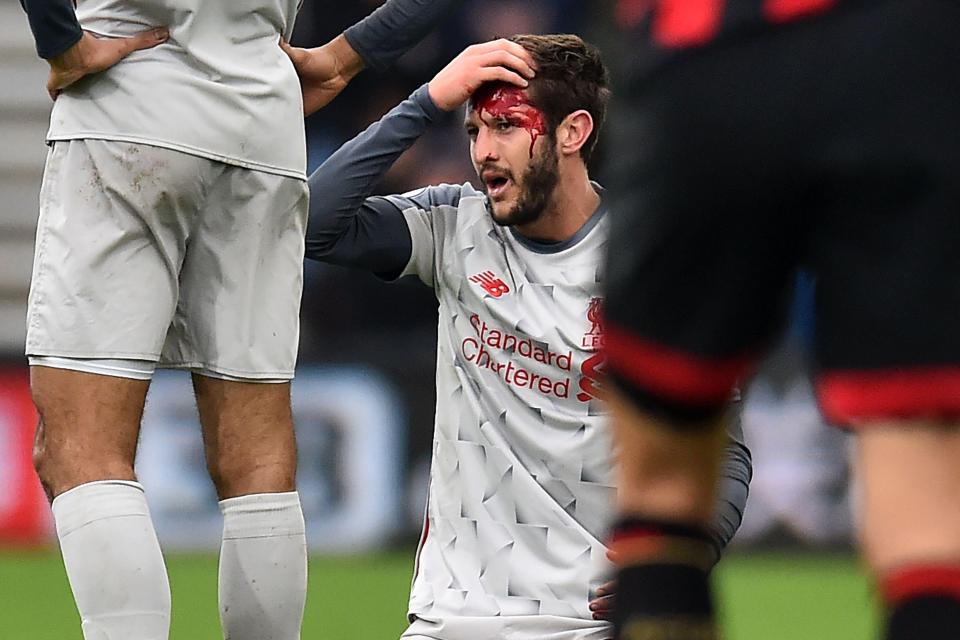  Adam Lallana was left covered in blood after a nasty clash of heads with Jefferson Lerma