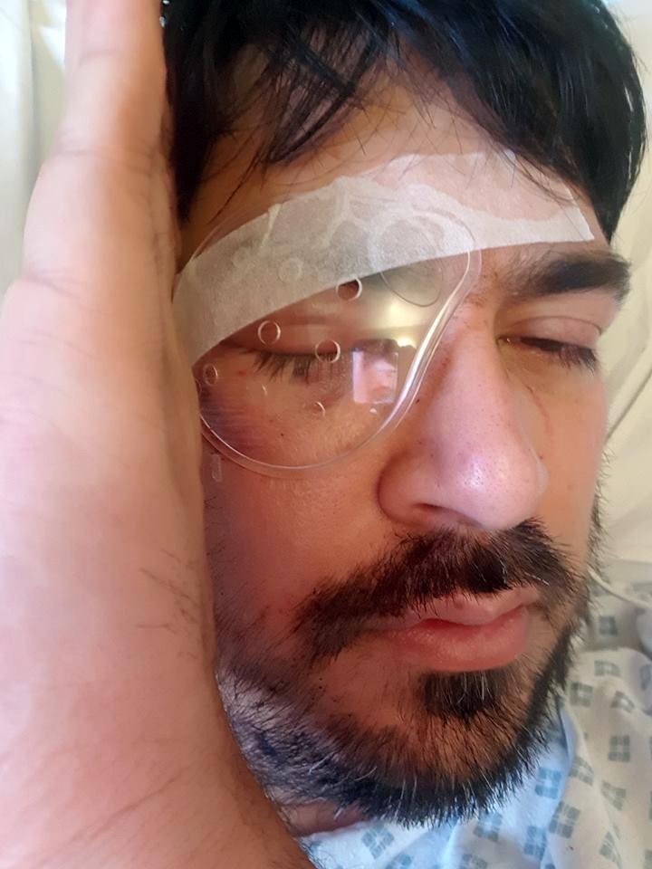  Afaq Iftikhar, 32, has told how he lost an eye after being hit by a drunk passenger's stiletto