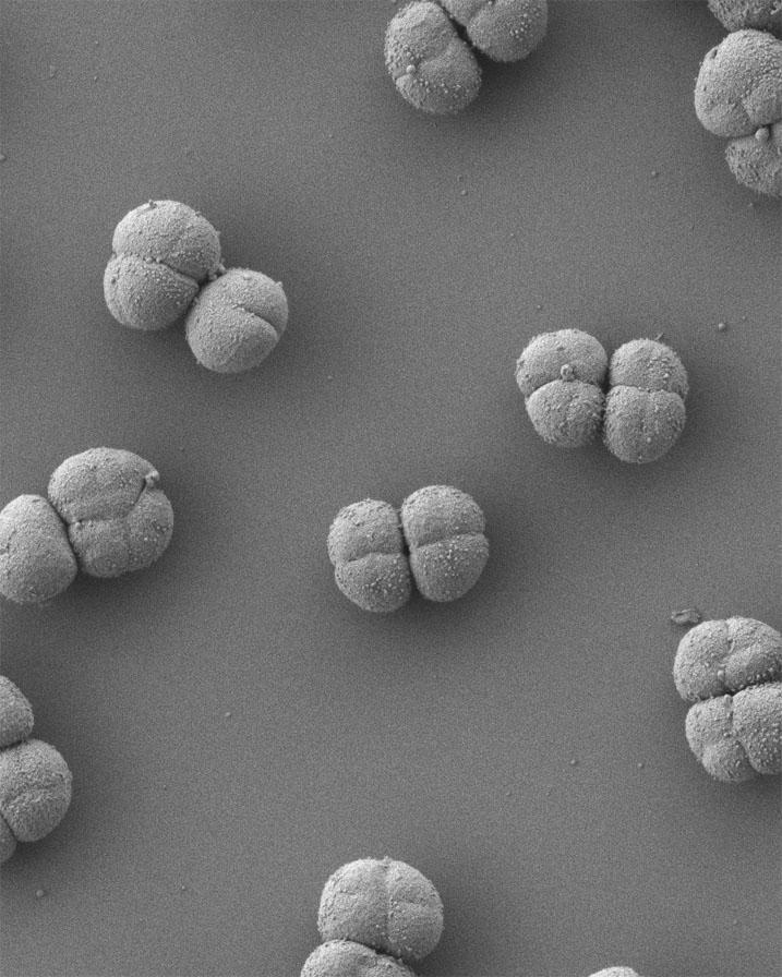  This type of bacteria can survive in the harshest of conditions and it is what researchers are hoping to find on Mars