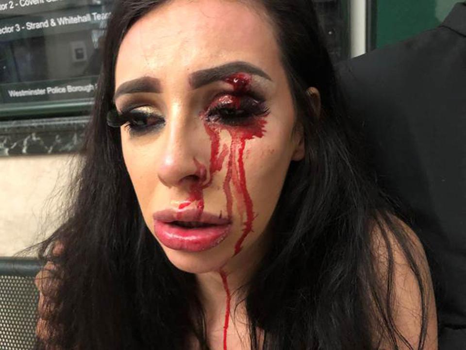  Today, we revealed ex-Apprentice star Elle Stevenson was left battered following a brutal mugging