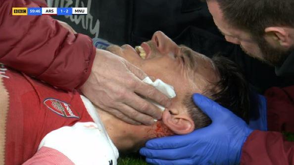  Laurent Koscielny was down injured for several minutes after being kicked in the head