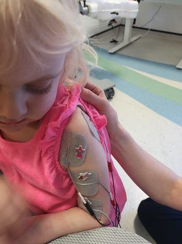  The three-year-old has lost all movement in her left arm due to the condition