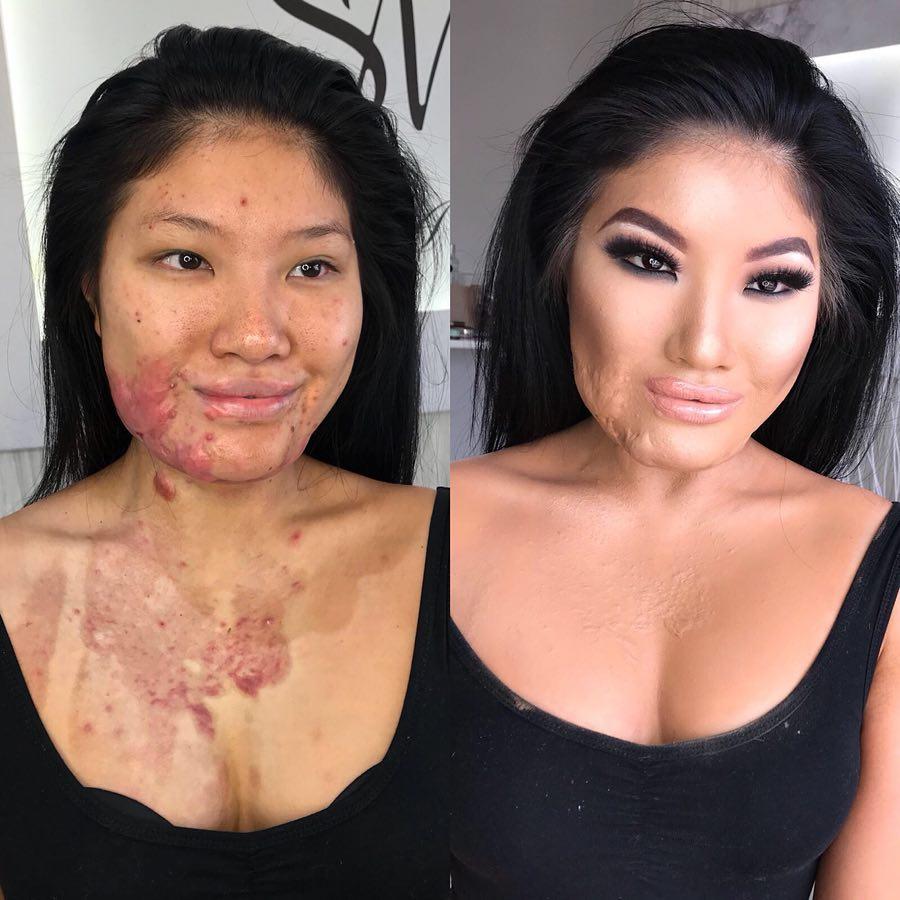  Fire dancer Sophie Lee was left scarred for life when an air-con unit blew flames back in her face. Pictured, left, natural, and with makeup