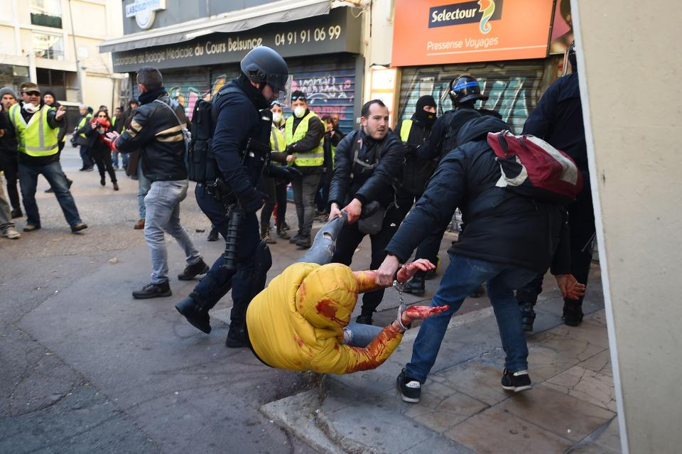  Police arrest a protester in a yellow jacket whose hands are covered in blood