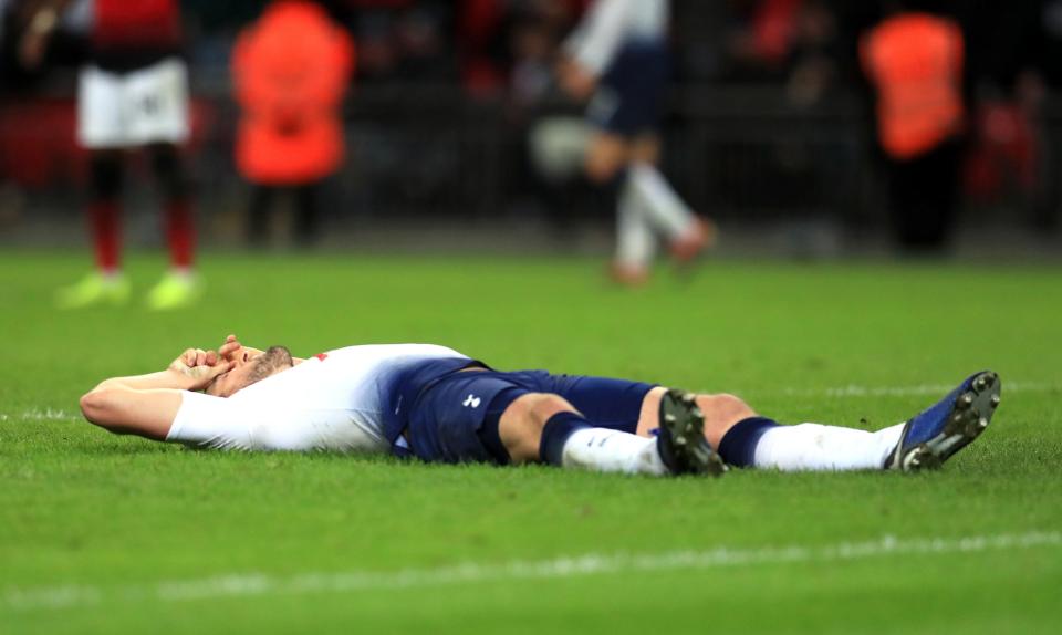  Dejected Harry Kane after suffering an injury in Tottenham's 1-0 loss to United