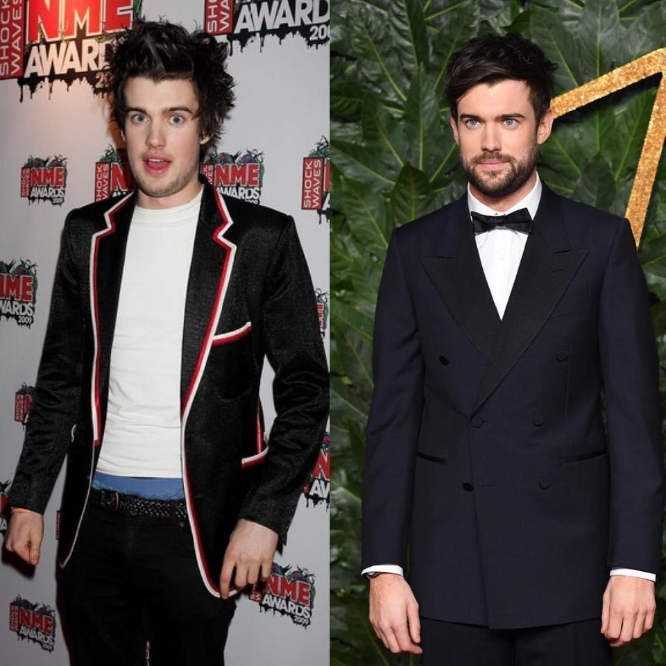  Jack Whitehall has shown off his incredible transformation in this throwback side-by-side snap