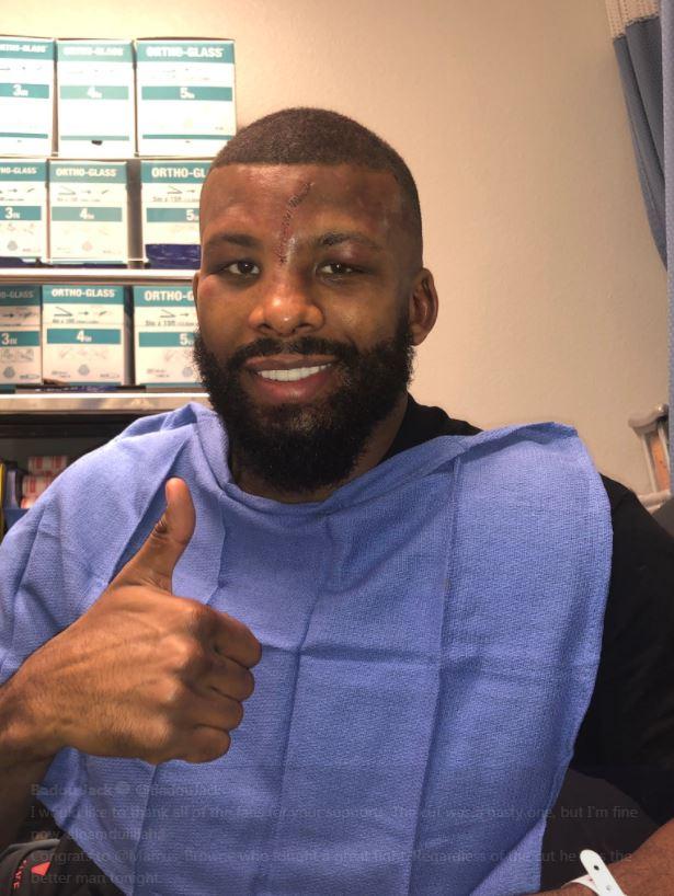  Badou Jack gave the thumbs up after having around 25 stitches in his forehead