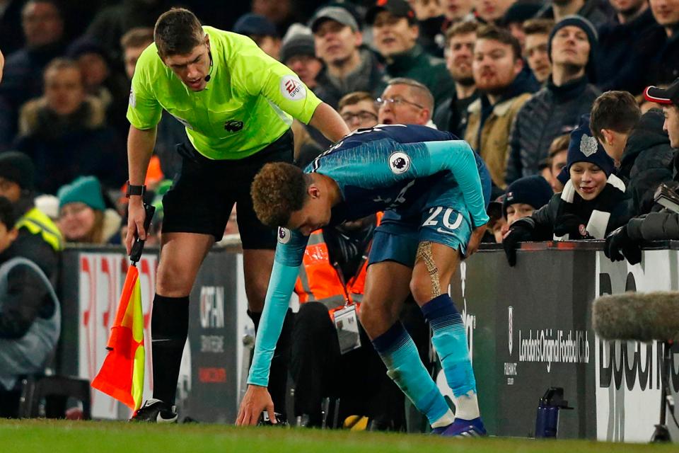  Alli looked to be a broken man as he limped off the pitch