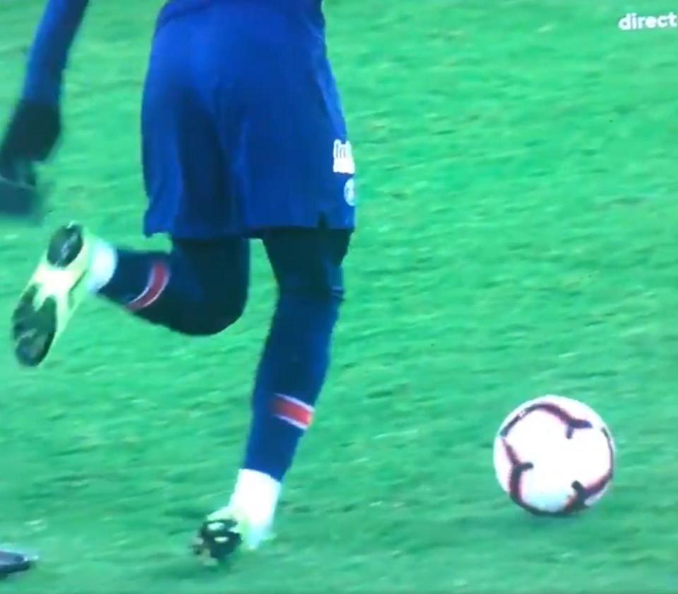  Neymar turns his ankle in the French Cup game with Strasbourg