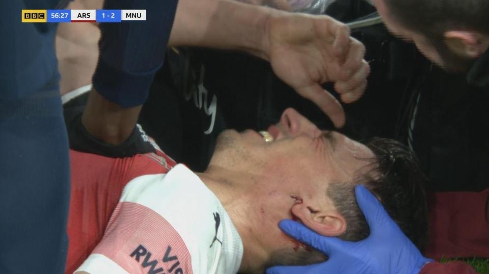  Laurent Koscielny was forced off after a clash with Romelu Lukaku