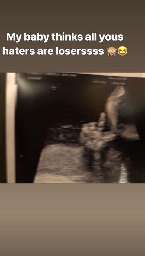  The former Geordie Shore star shared this pic of unborn child apparently giving the finger to her 'haters'