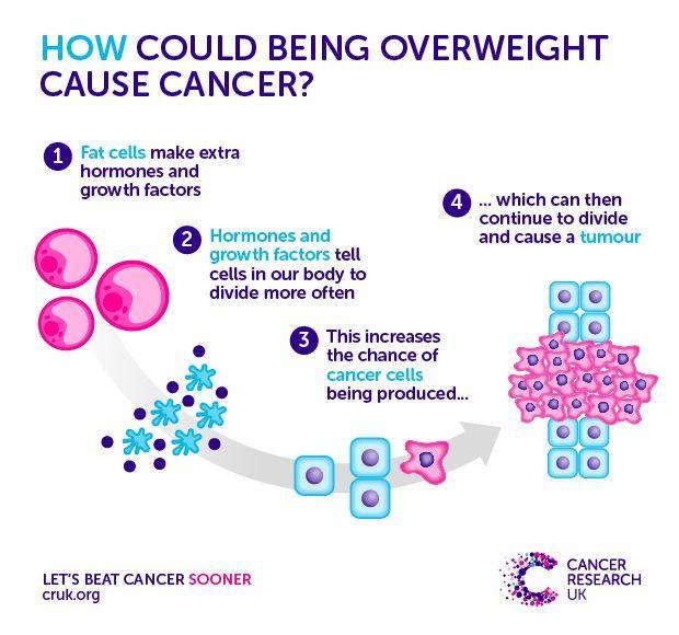  Obesity is one of the leading causes of cancer in the UK