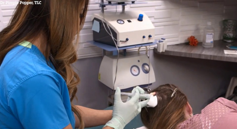  Dr Pimple Popper numbs the top of her head in preparation for removing it