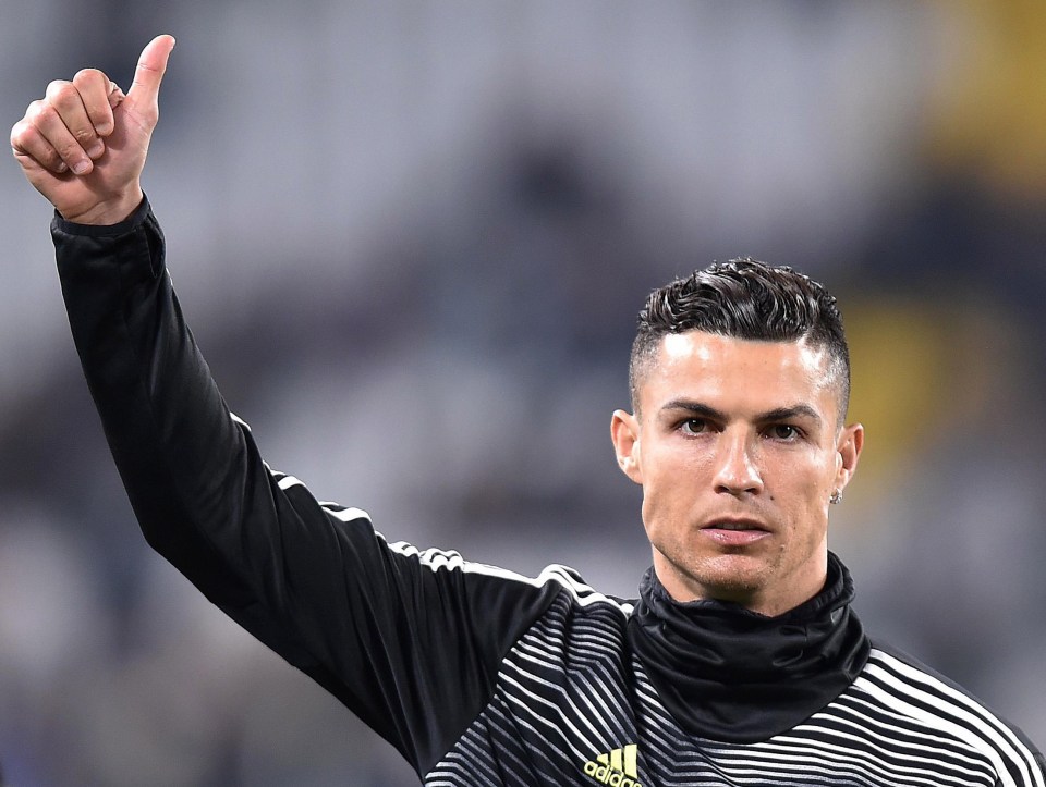  Ronaldo admitted that he would be open to having a hair transplant