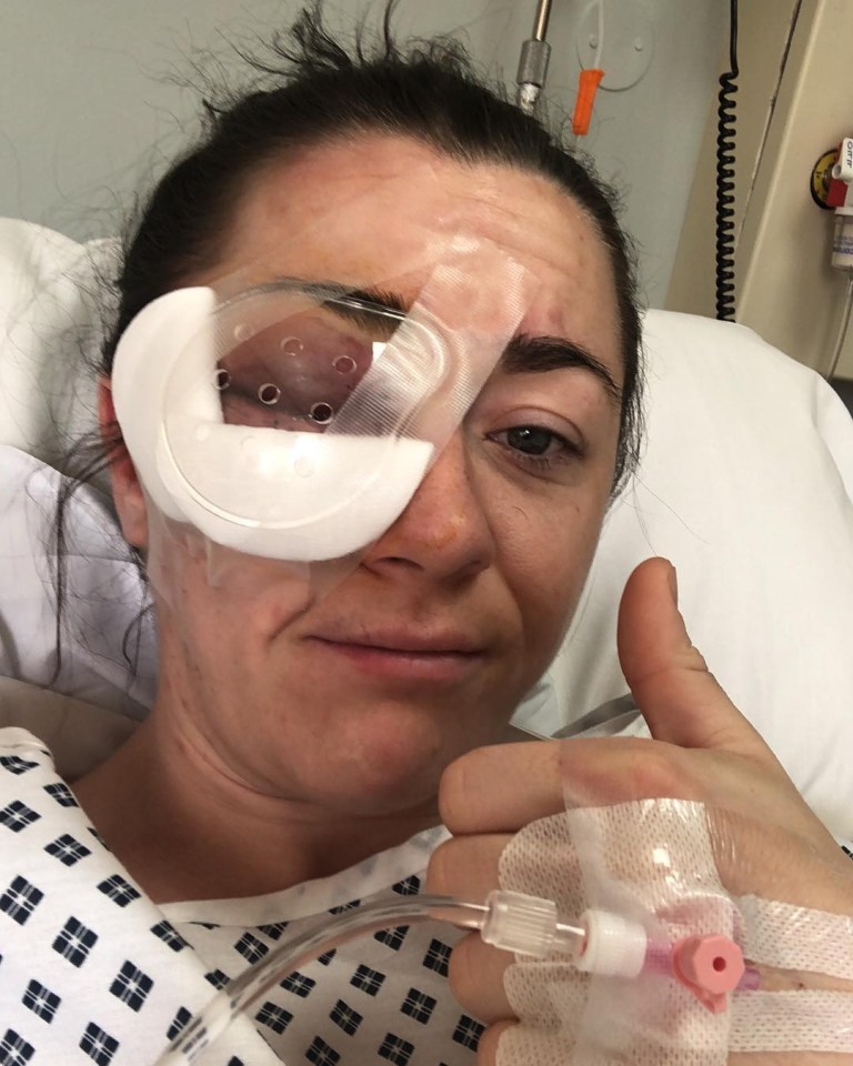 Molly McCann suffered a gruesome injury to her eye following her UFC fight on Saturday