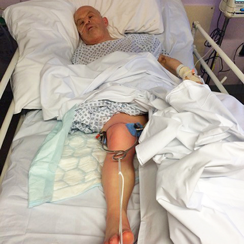  The 61-year-old was admitted to Manchester Royal Infirmary February 2016 after suffering a severe fall