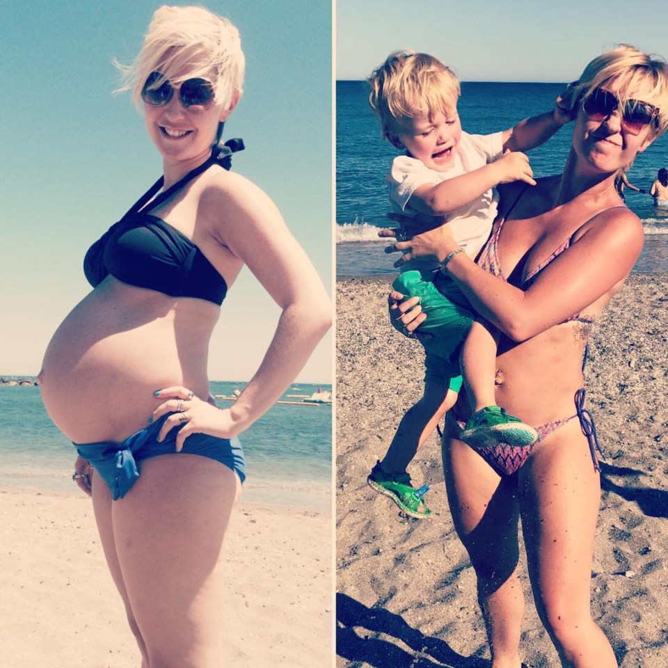  Lots of Amy's post-baby body changes have been permanent