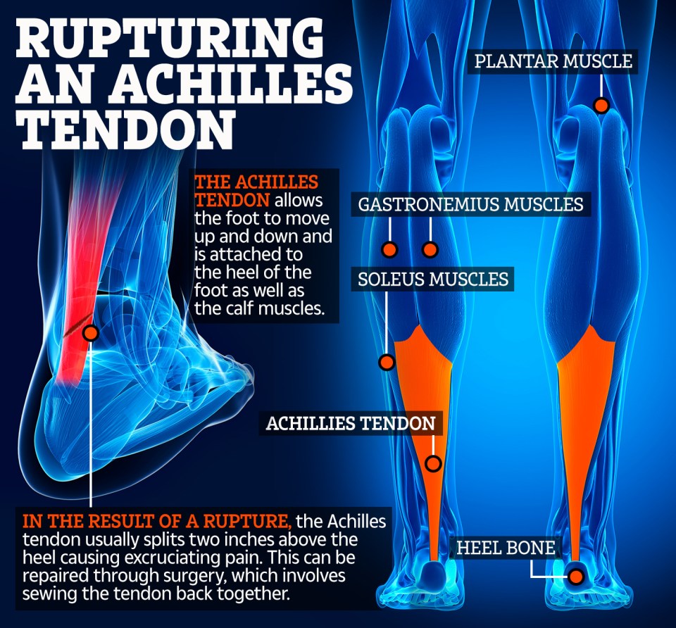  How Hudson Odoi's Achilles tendon was ruptured and how it was fixed