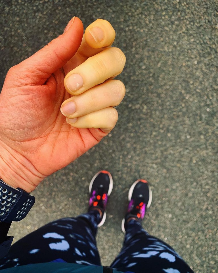  In Jenni's latest post about the disease, she explains how her bones 'literally chill'