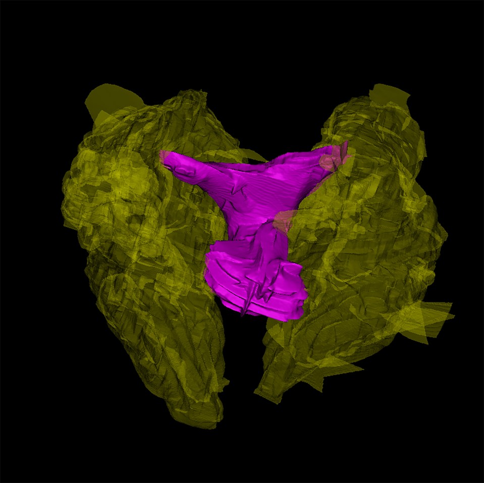 Computer reconstruction of the clitoris of the bottlenose dolphin, which researchers say is remarkably similar to the human clitoris