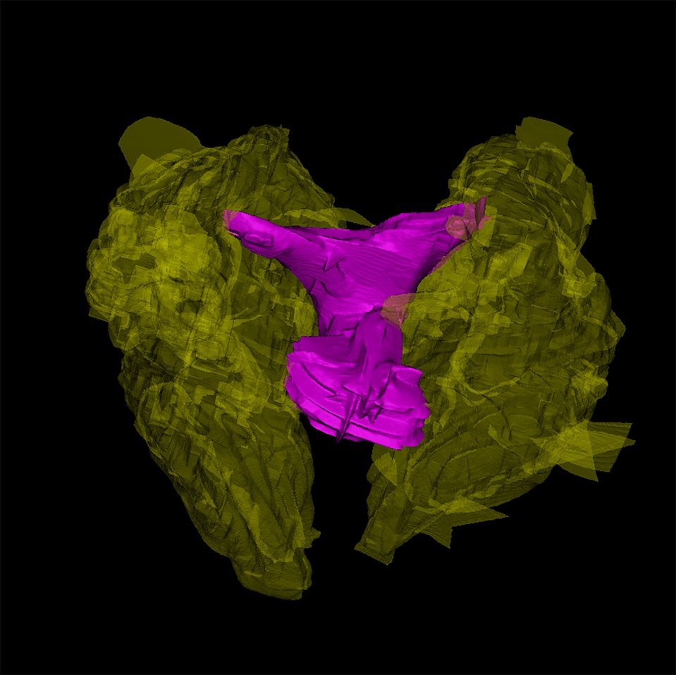  Computer reconstruction of the clitoris of the bottlenose dolphin, which researchers say is remarkably similar to the human clitoris