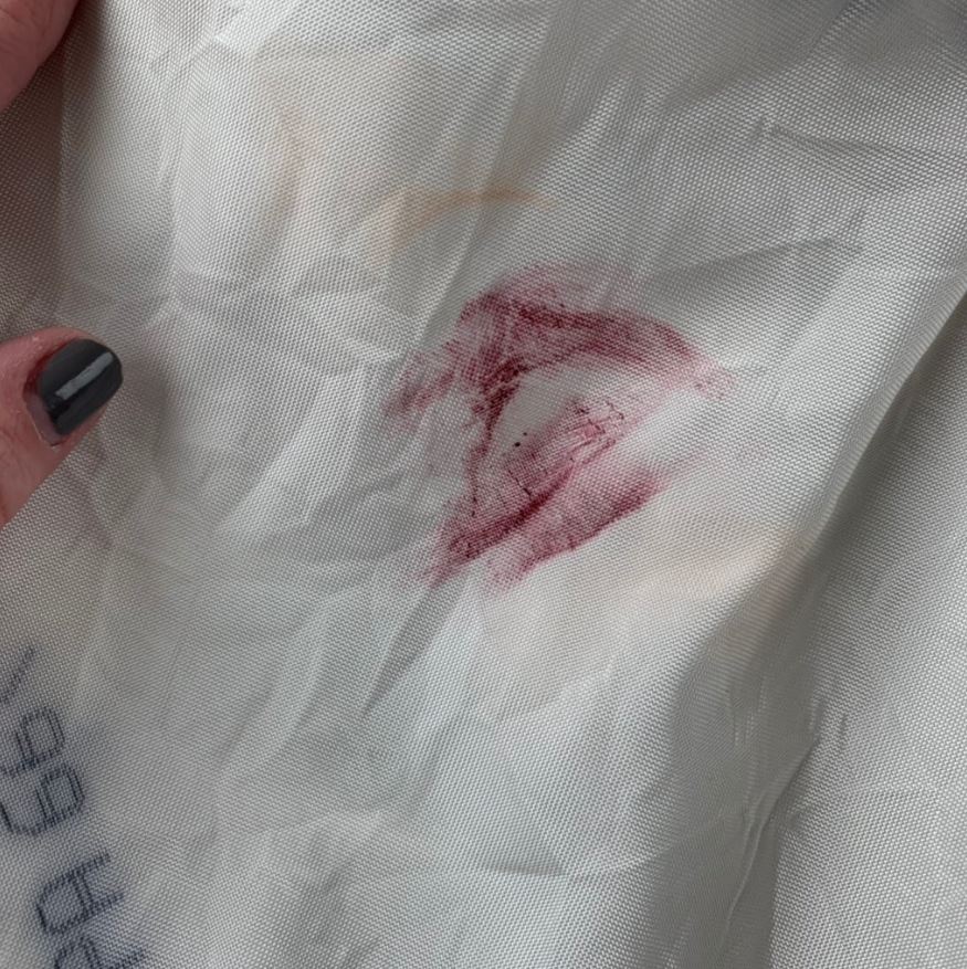  The force of the impact left a lipstick stain on the airbag