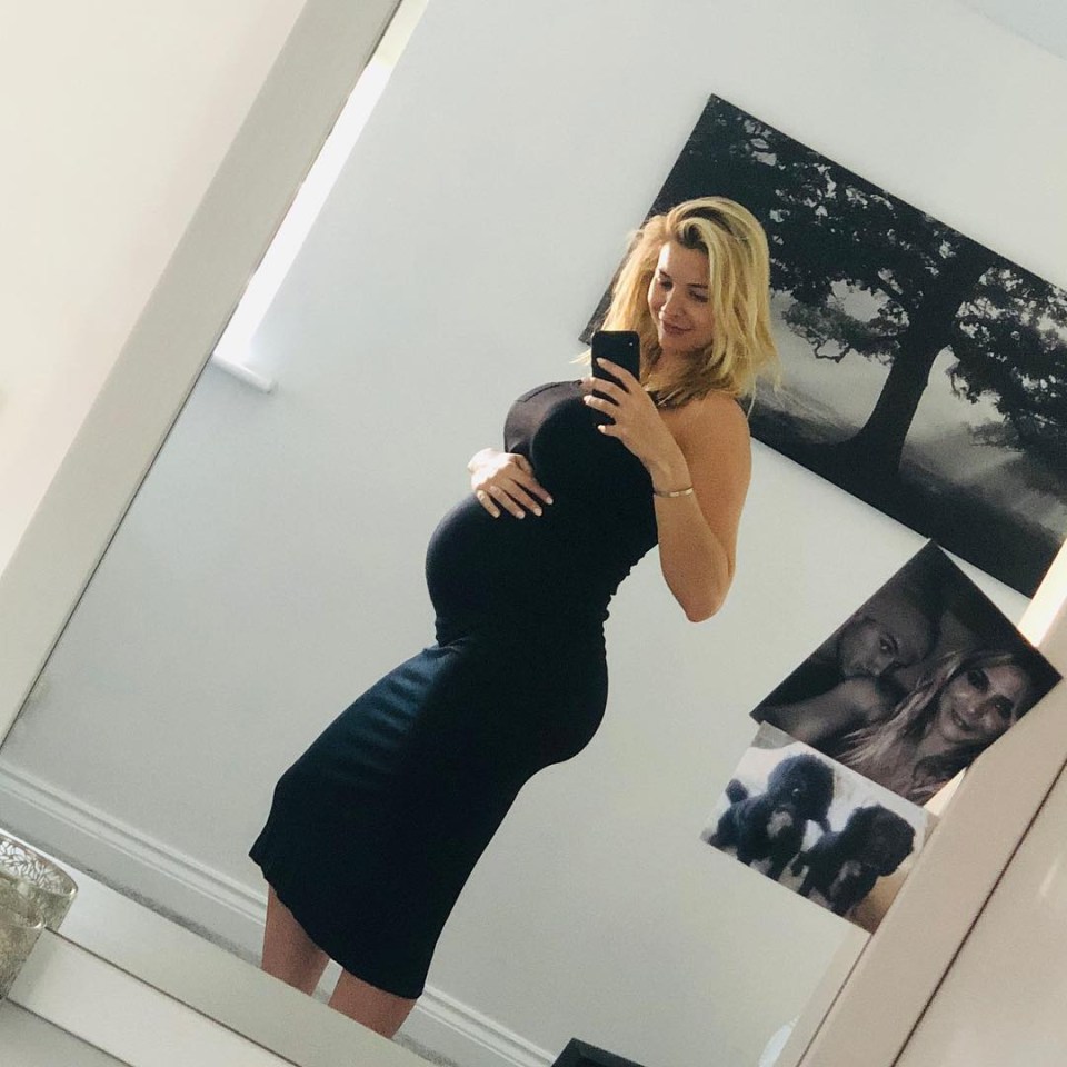  Gemma Atkinson has spoken of fears of tearing her privates during birthing