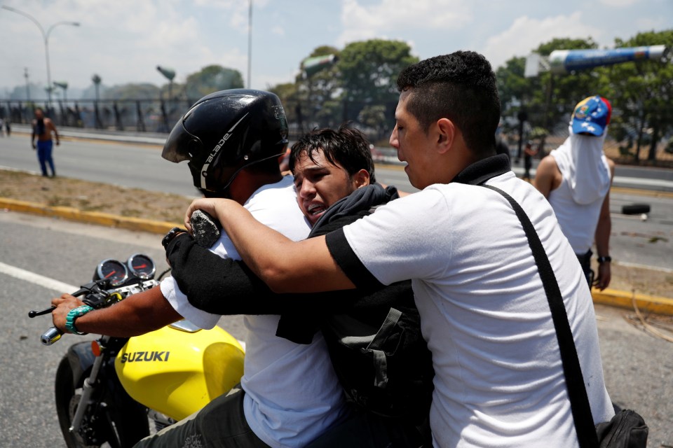  With no ambulances available, this casualty has to ride on a scooter to hospital