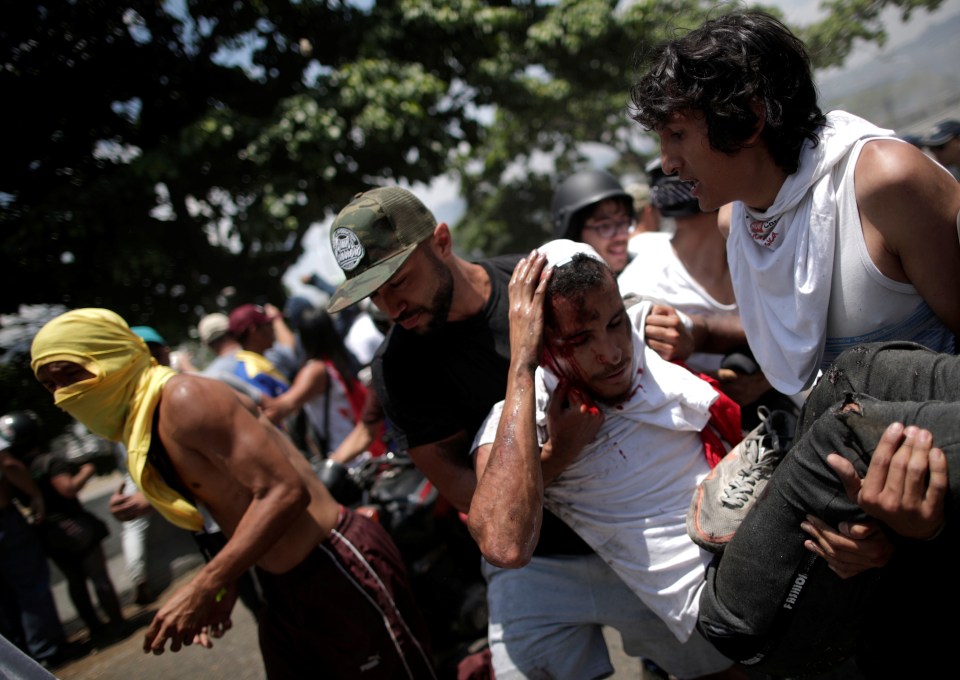  The injured protester is taken away with his bleeding head while being carried by fellow protesters