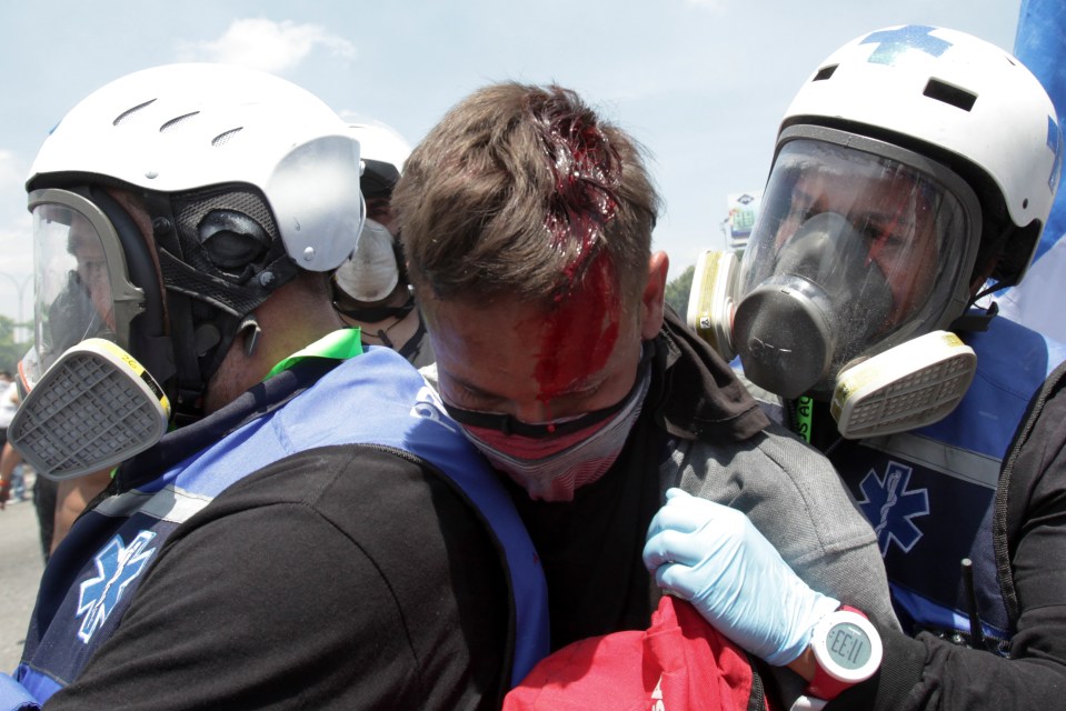  This man is being taken on a scooter to hospital