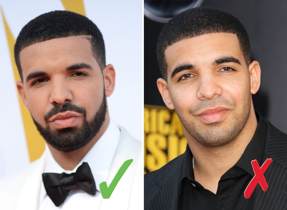  Drake looks good both ways, but the facial hair is on song