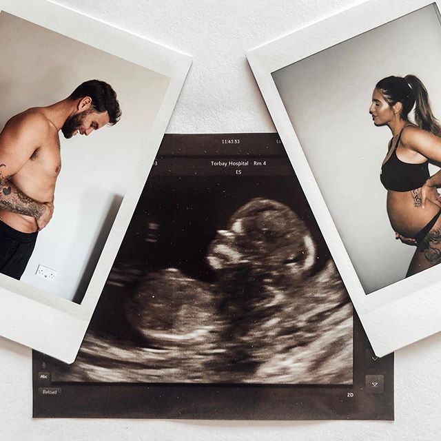  The couple shared their baby news last month