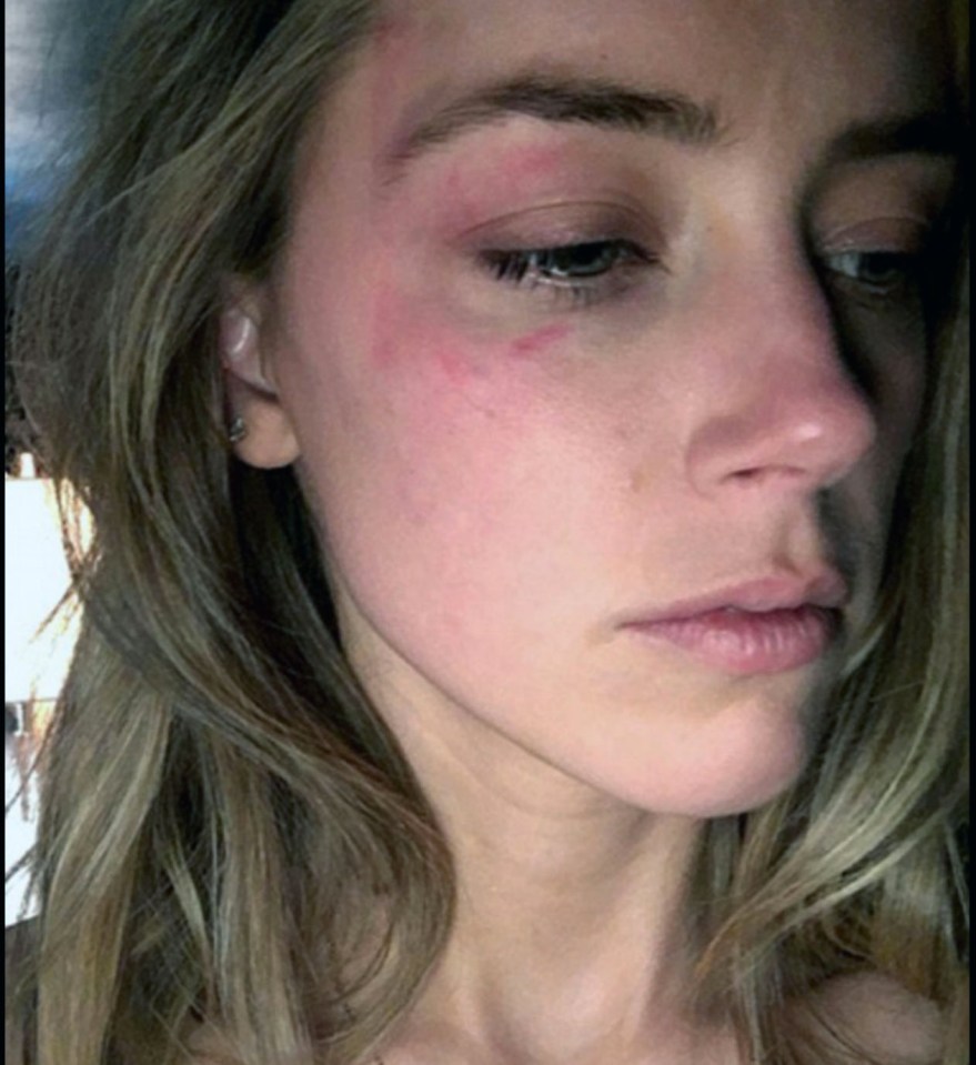  Amber Heard told a newspaper she was a victim of domestic violence