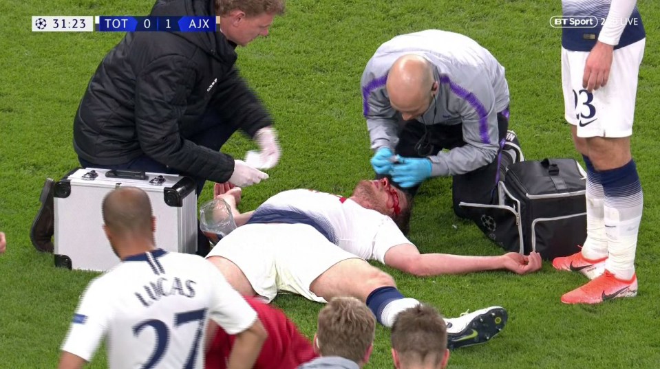  Jan Vertonghen was left bleeding from his nose after a horror head clash with Toby Alderweireld