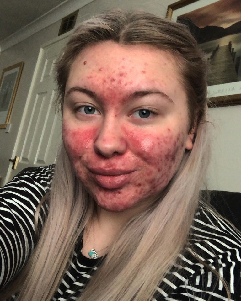  Abigail now feels confident enough to leave the house without any makeup on