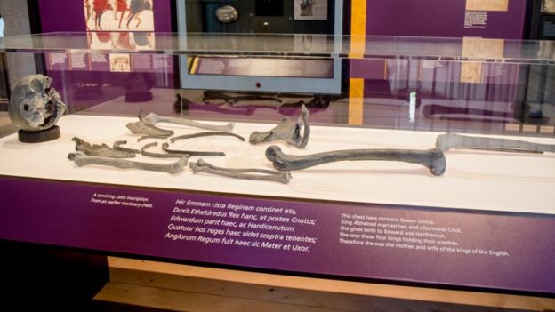  Casts of her bones are going on display at a Winchester Cathedral exhibition