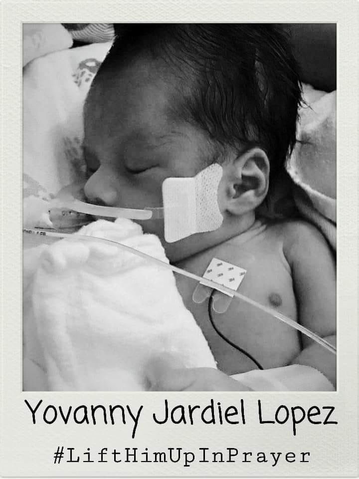 Yavani Yardiel Lopez has been left with zero brain function, but his family are praying for a miracle