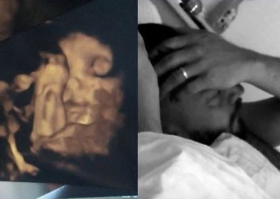  Mrs Hinch uploaded a scan of her baby sleeping in the same position as her husband Jamie