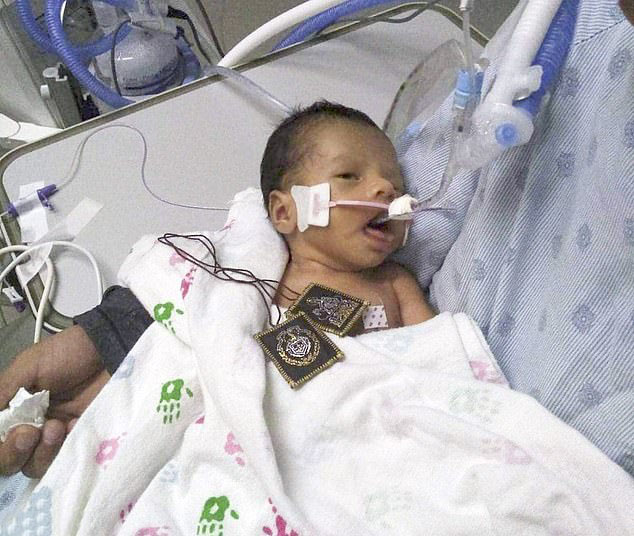 Little Yavani Yadiel Lopez is fighting for life in hospital after being ripped from his murdered mum’s womb