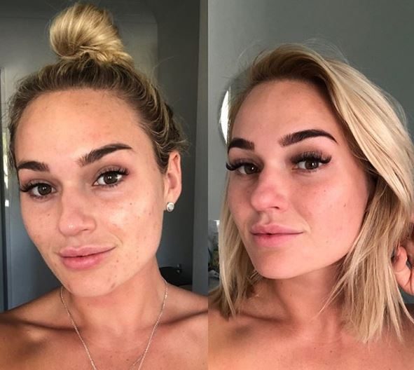 She posted photos of her skin from January (left) and May to show the visible difference