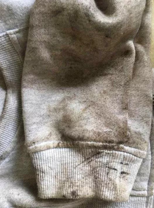 A mum revealed how she used cola to remove oil stains from her young son’s hoody