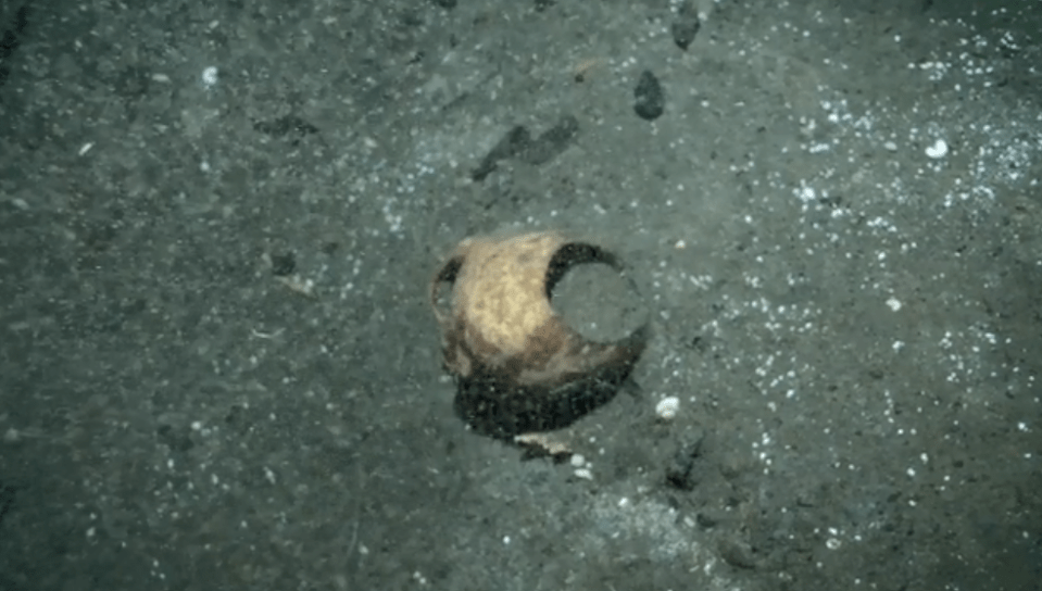  A perfectly cut hole was drilled into the skull hundreds or even thousands of years ago