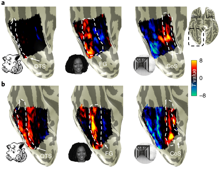  The areas of the brain activated when recognising (l-r) a Clefairy Pokémon, a face, and a corridor