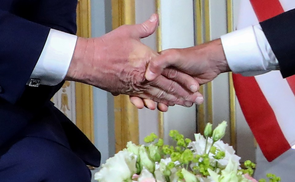  Emmanuel Macron left his thumb print on Donald Trump's hand