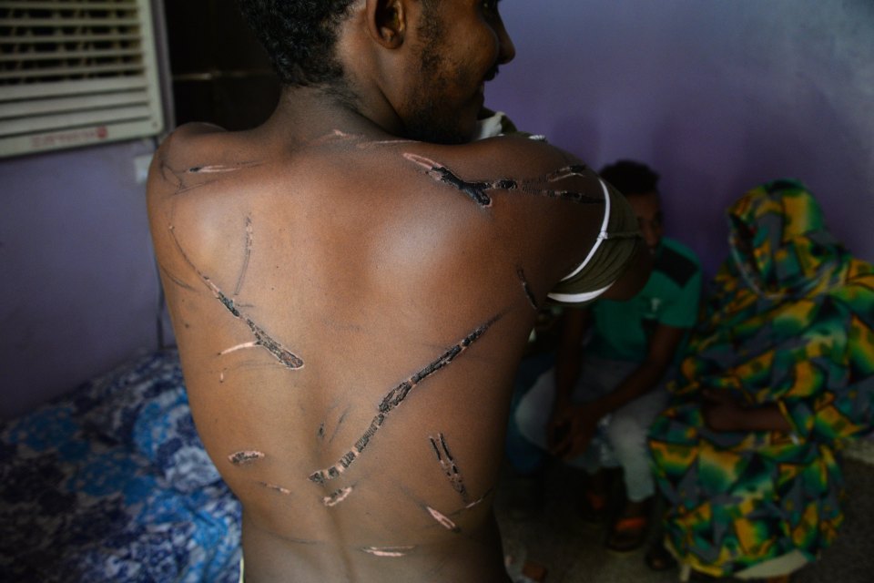  Ali Idris, 18, shows injuries he suffered when security forces broke up protests last week