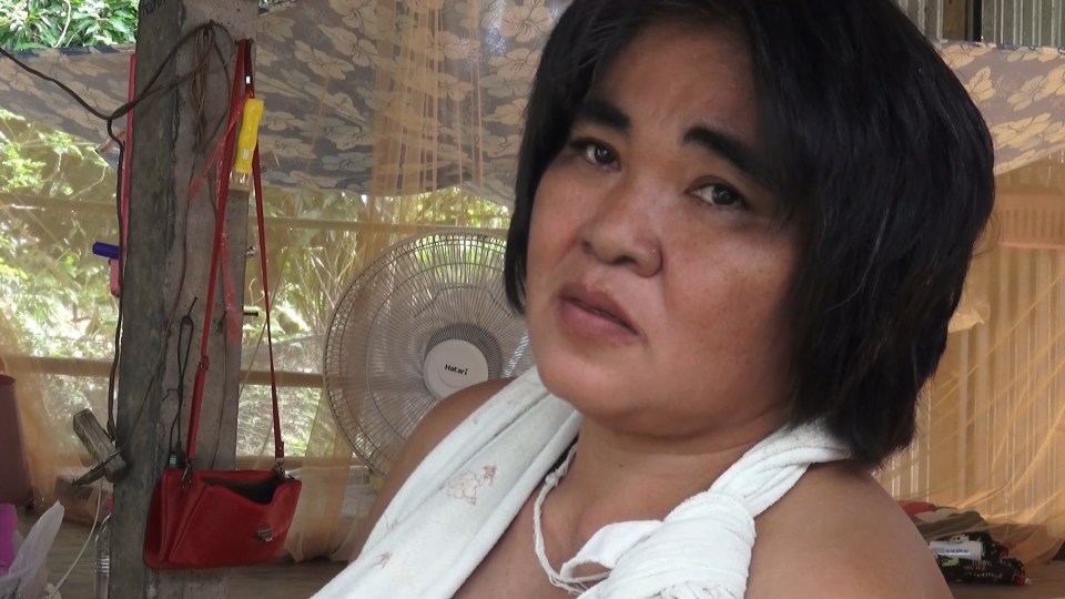  She has appealed for help in getting funds so she can have surgery to reduce her breasts