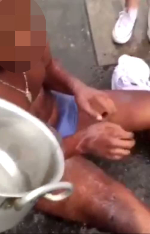 A man is doused with water after he had the corrosive substance thrown at him