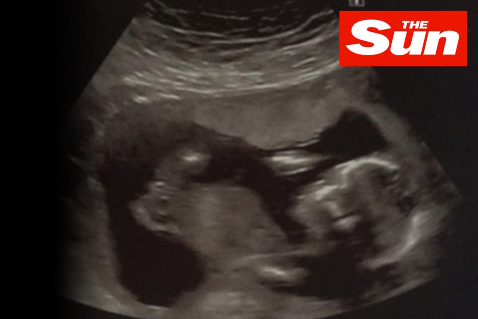  Jeremy and Katie also shared a recent scan of their new arrival