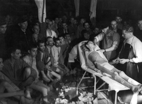  Czech doctors examine an emaciated Hungarian Jew, following the liberation of Buchenwald