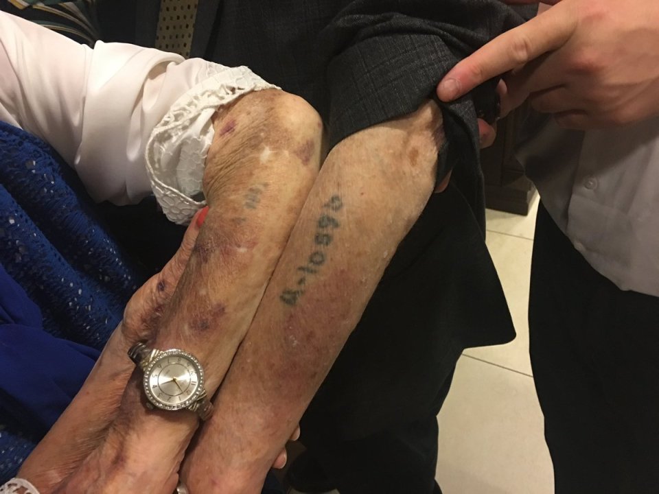  Kor, left, shows some of the scars she gained during her time at the concentration camp